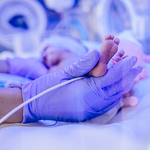 Newborn being treated with UV Therapy in Neoanatal unit